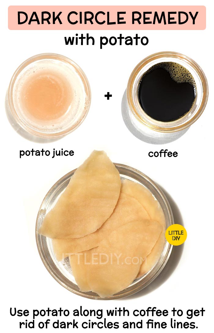 Potato for overnight dark circles remedy -