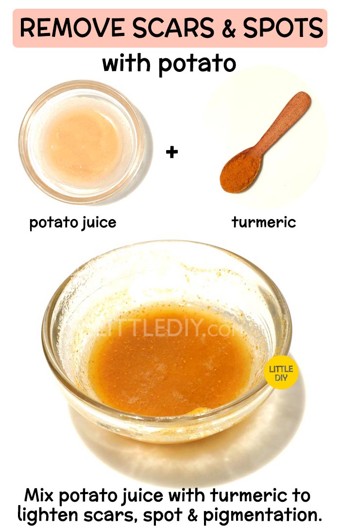 Overnight Potato Remedy for scars and pigmentation -
