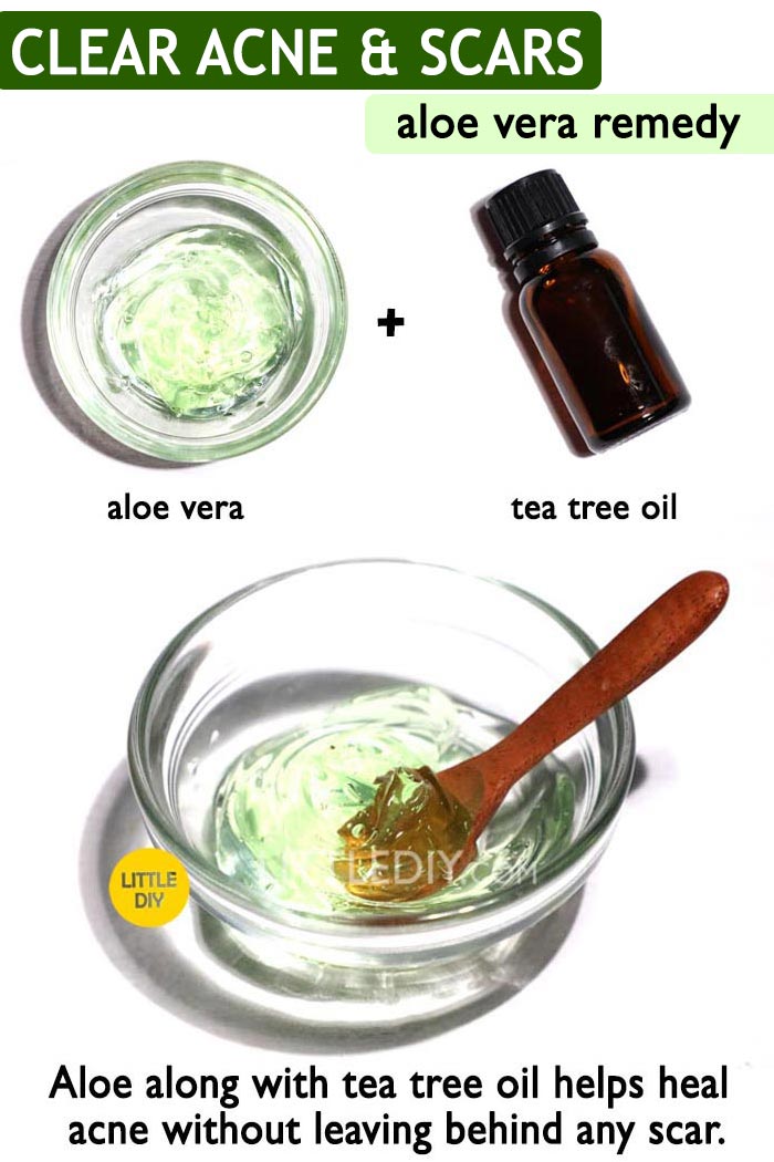 Aloe vera for Acne & Scars-