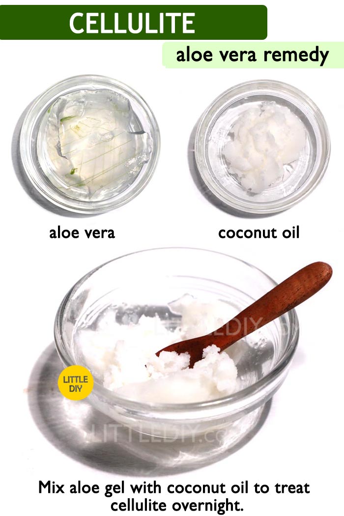 Aloe vera for cellulite -
