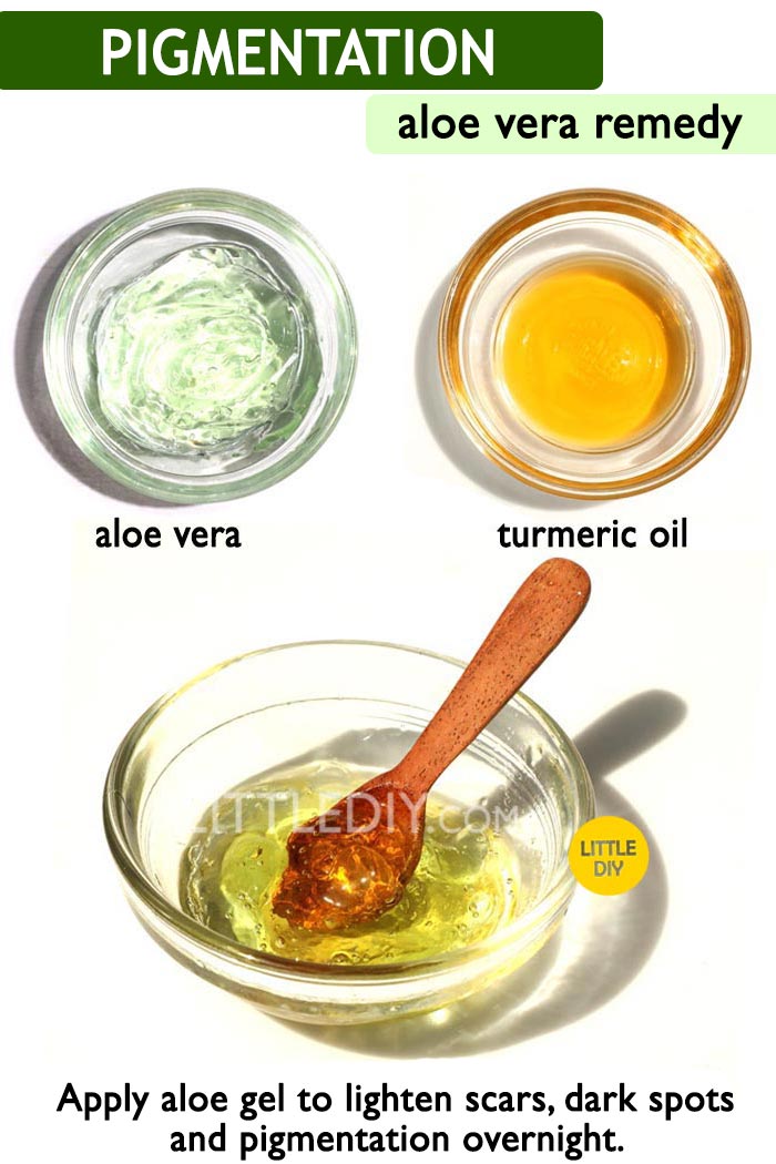 Aloe vera for Pigmentation -
