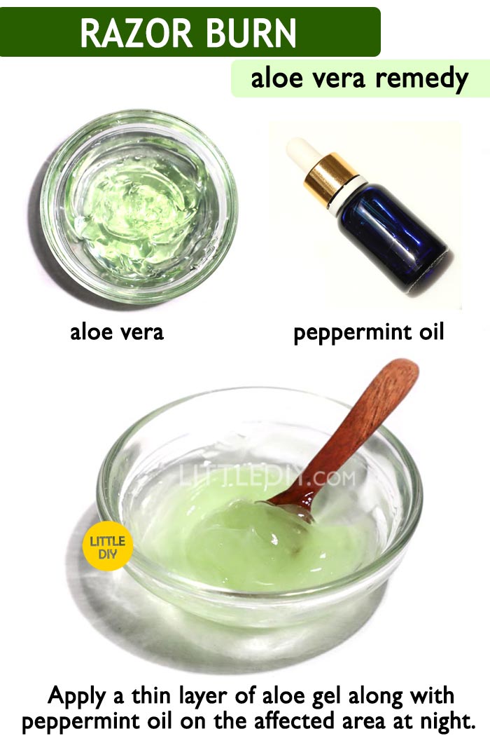 Aloe vera for Razor burn -