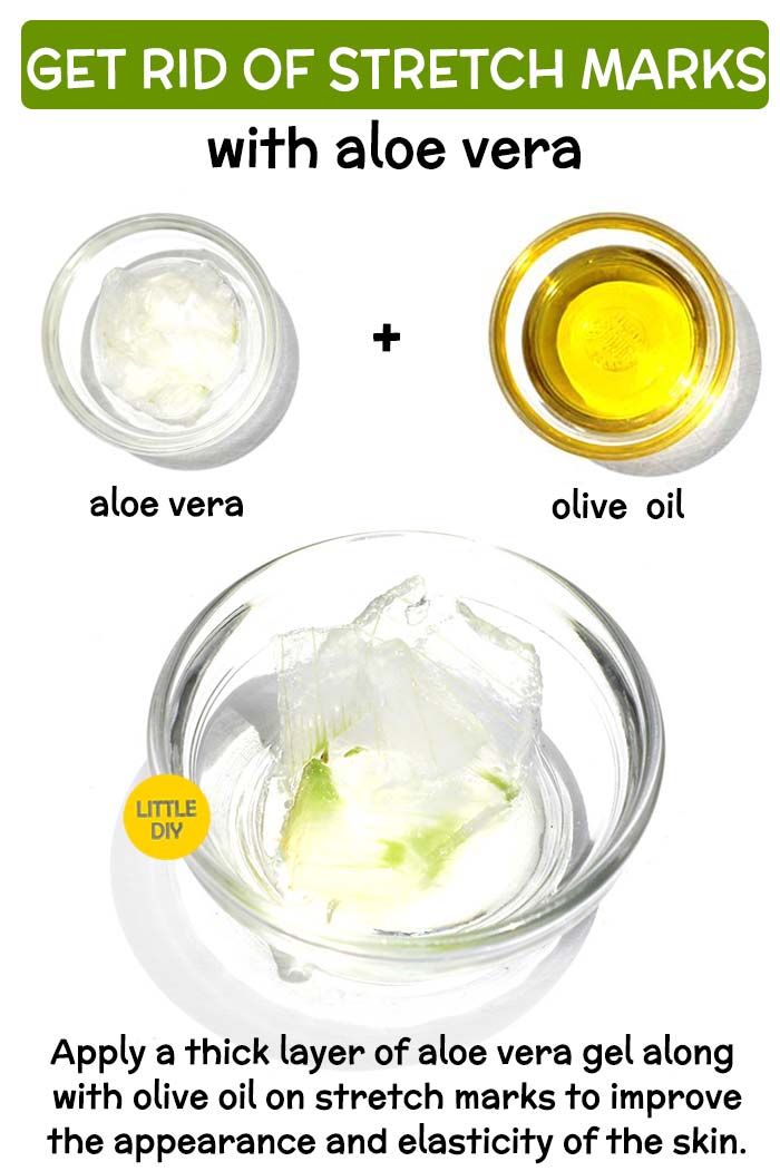 OVERNIGHT STRETCH MARKS REMEDY