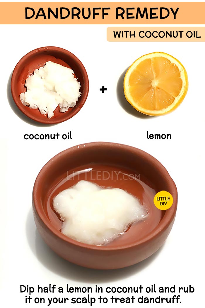 Coconut Oil dandruff Remedy -