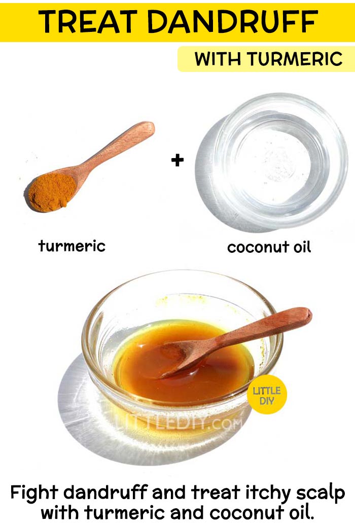 Dandruff remedy with turmeric -