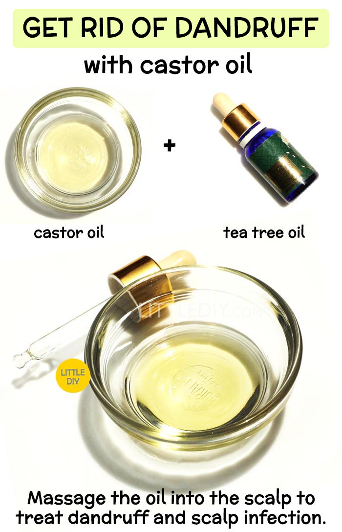 Overnight Castor oil Hair Mask to get rid of dandruff: