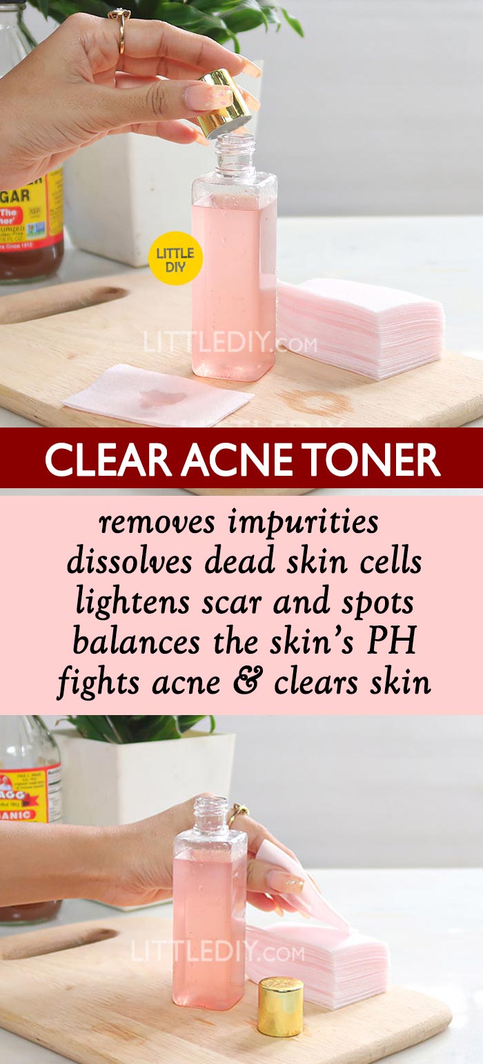 HOMEMADE CLEAR ACNE TONER