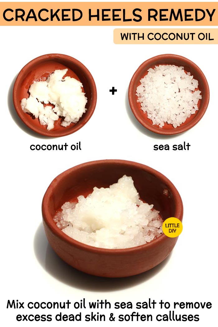 Coconut Oil cracked heels Remedy -