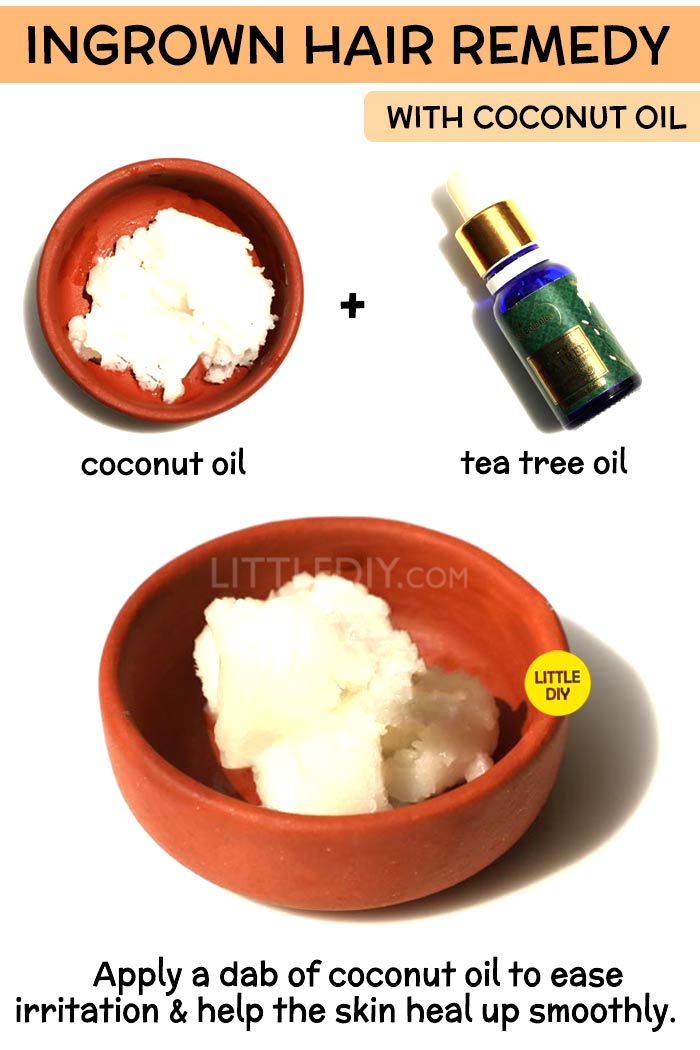 Coconut Oil ingrown hair Remedy -