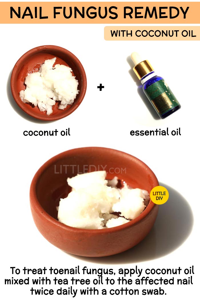 Coconut Oil nail fungus Remedy -