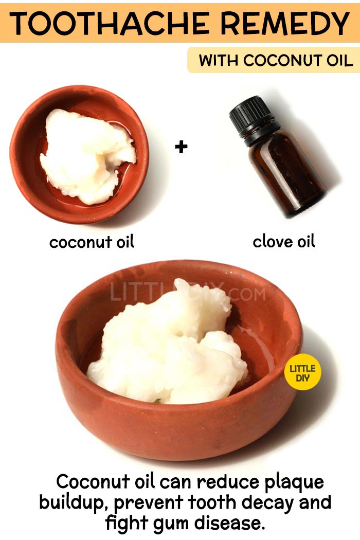 Coconut Oil Toothache Remedy -