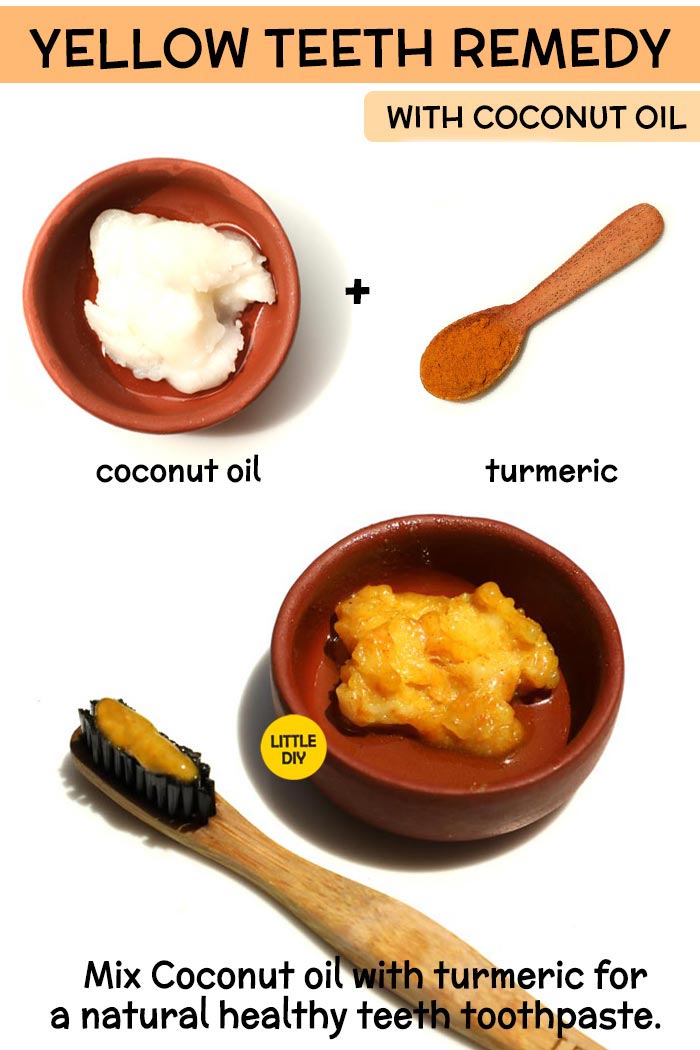 Coconut Oil yellow teeth Remedy -