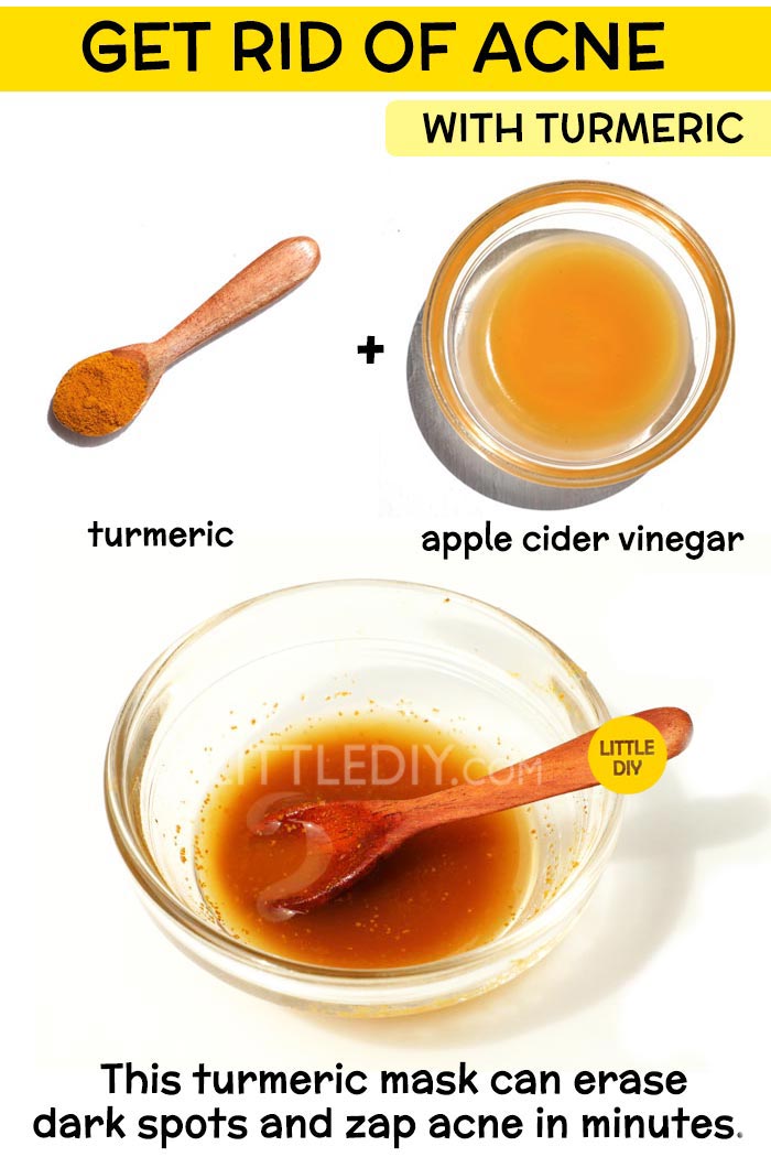 Get rid of acne with turmeric -