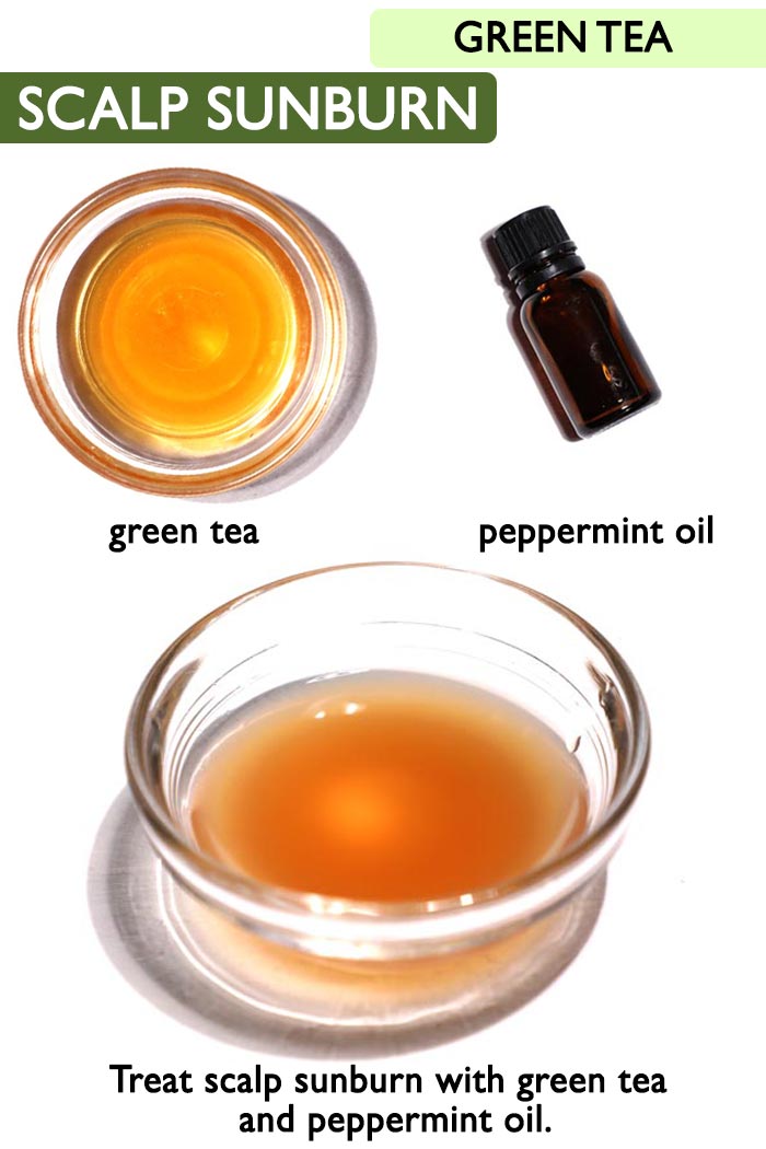 Green tea Scalp sunburn -