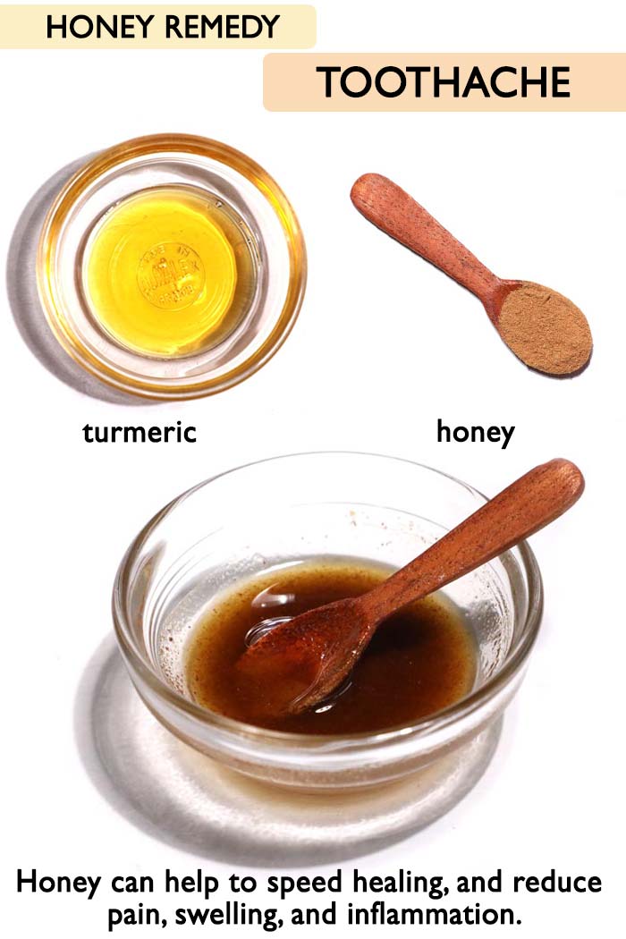 Honey for toothache -