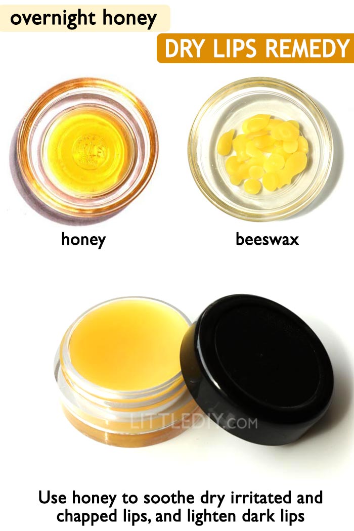 Dry chapped lips -