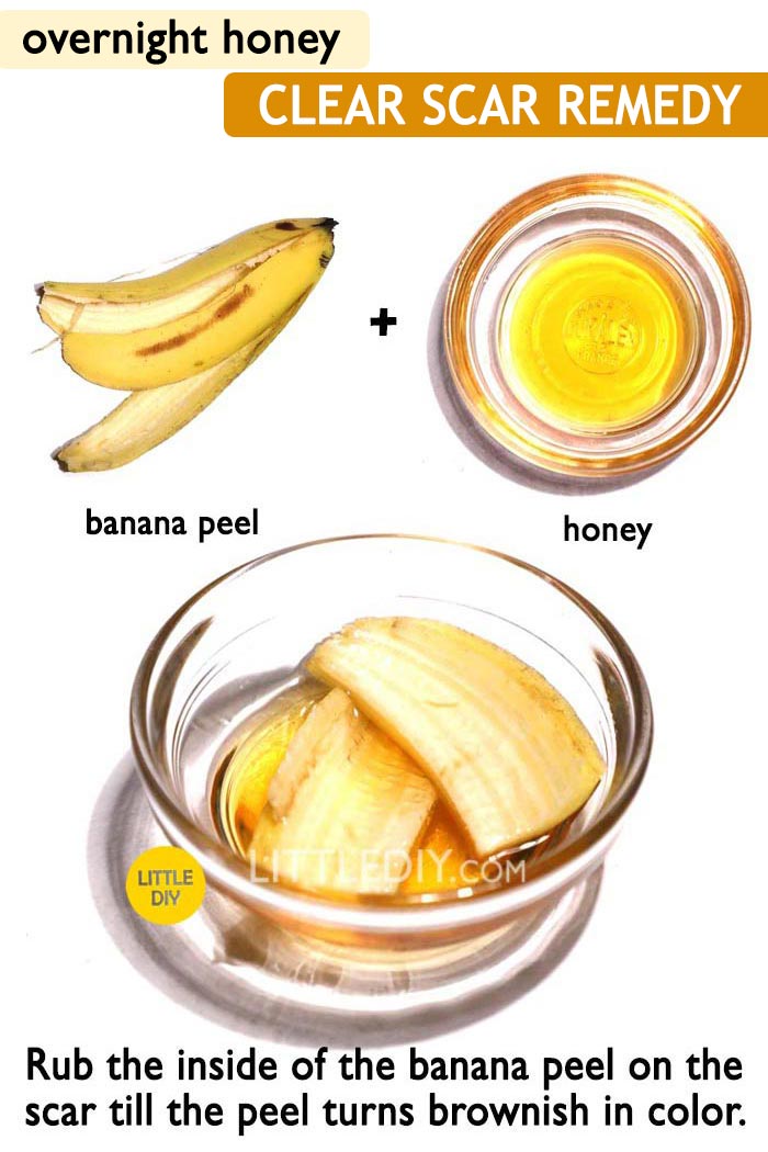 Honey overnight Pimple / Acne remedy -