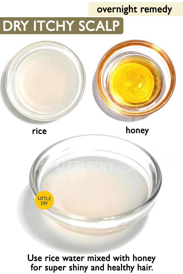 Overnight dry and itchy scalp remedy -