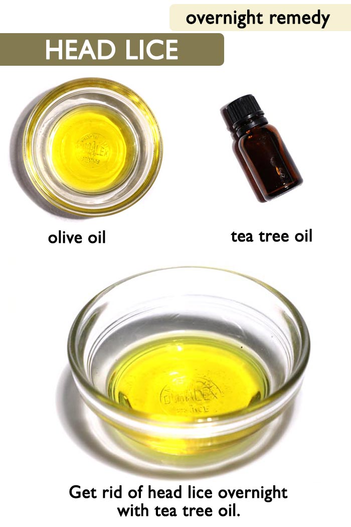 Treat head lice overnight -