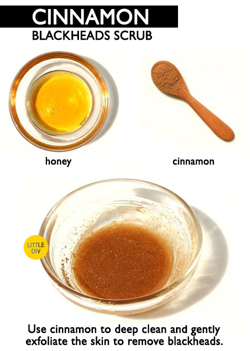 cinnamon blackheads remover