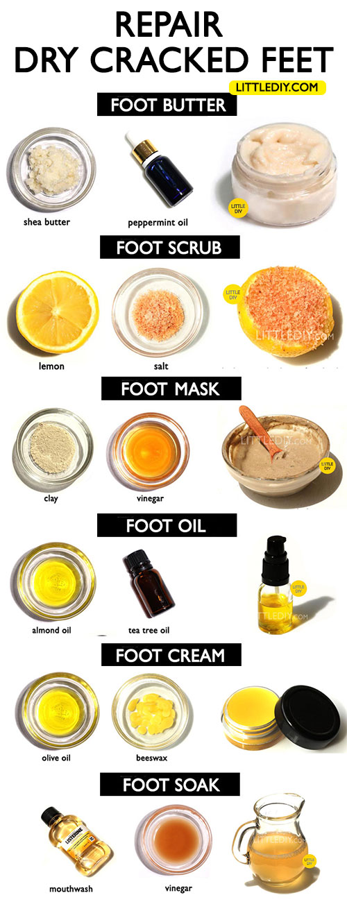 6 REMEDIES TO SOFTEN DRY CRACKED FEET