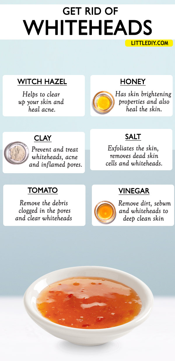 GET RID OF WHITEHEADS